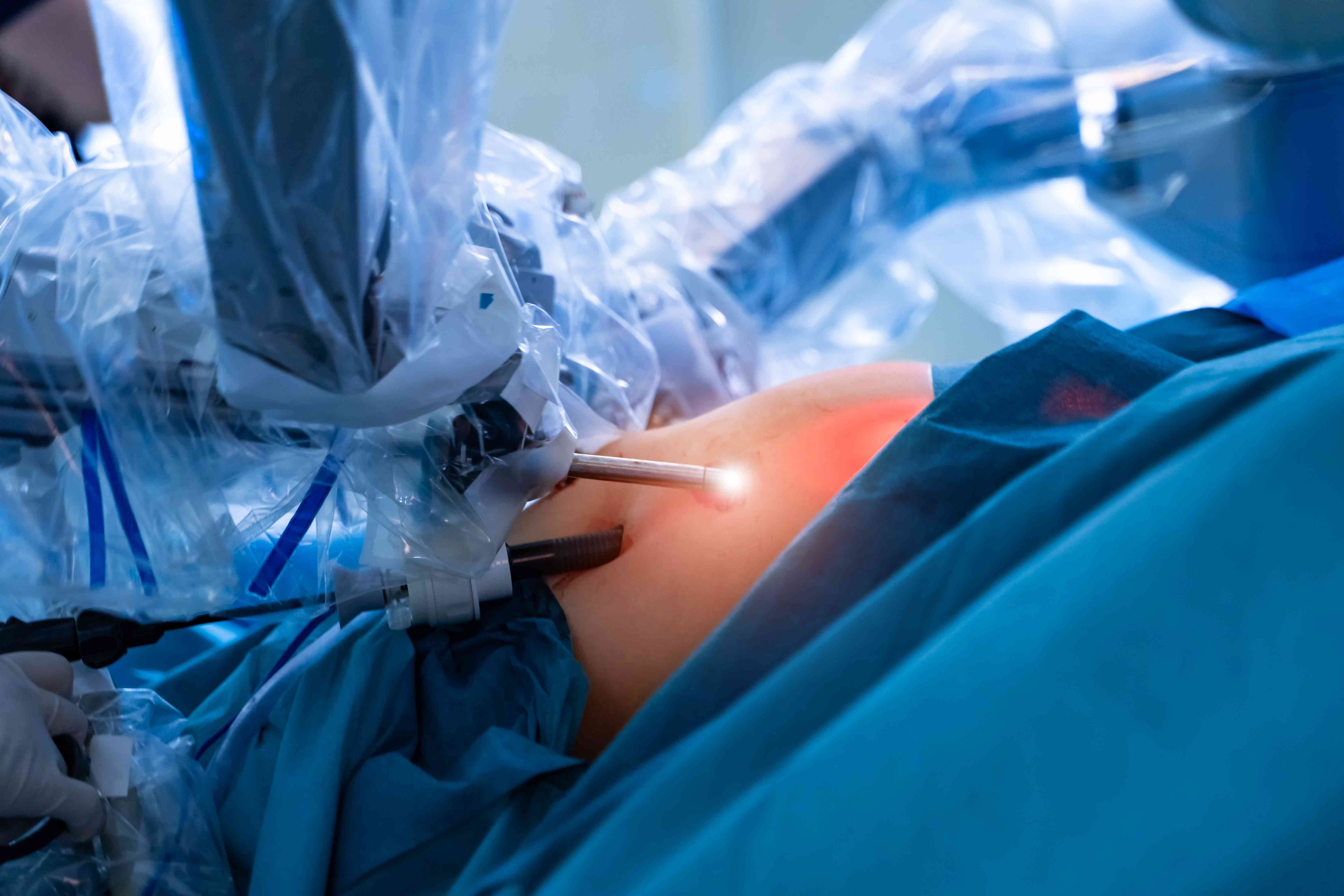 surgical-room-hospital-with-robotic-technology-equipment-davinci-robot-compressed (3)
